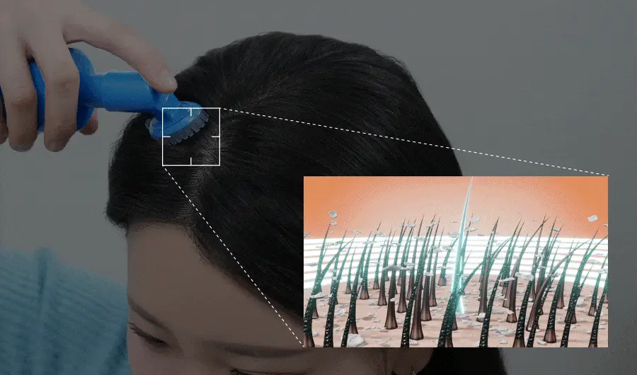 [두피각질케어/노워시]씨퓨리 닥터33 딥샷 100ml 상세페이지 9